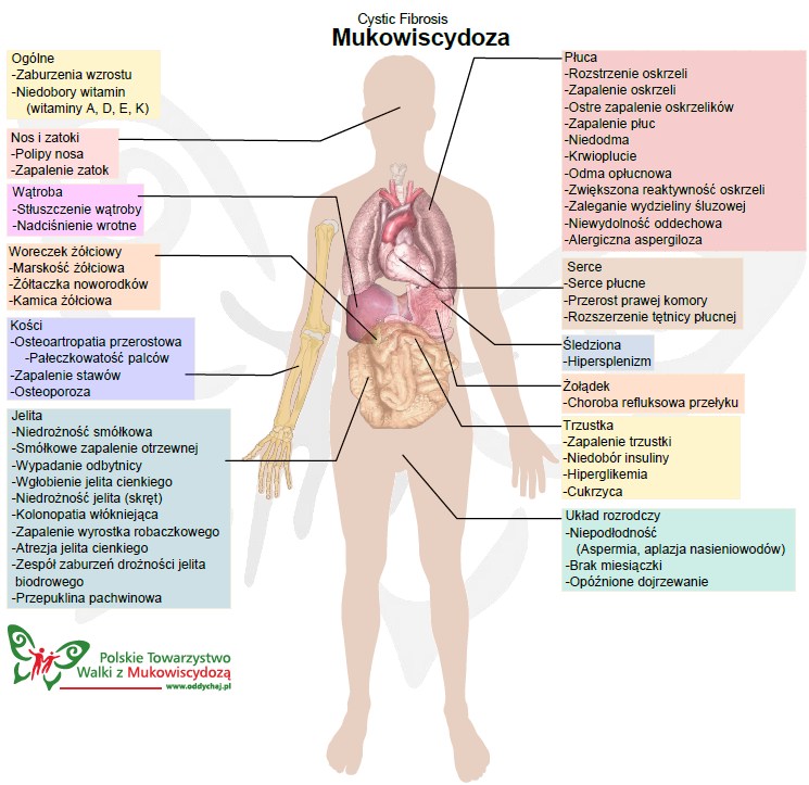 mukowiscydoza_infografika